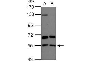WB Image Sample (30 ug of whole cell lysate) A: NT2D1 B: U87-MG 7. (PACSIN2 antibody)