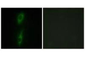 Immunofluorescence analysis of HeLa cells, using ACVL1 antibody. (ACVRL1 antibody)