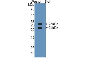 Western blot analysis of the recombinant protein. (ORM1 antibody  (AA 19-207))