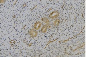 ABIN6277074 at 1/100 staining Human uterus tissue by IHC-P. (IL-13 antibody  (N-Term))