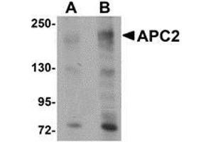Western blot analysis of APC2 in HeLa cell lysate with AP30058PU-N APC2 antibody at (A) 1 and (B) 2 μg/ml. (APC2 antibody  (Center))