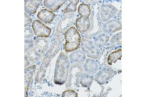 Immunohistochemistry of paraffin-embedded mouse kidney using FB2 Rabbit pAb (ABIN7267112) at dilution of 1:100 (40x lens). (FAM160B2 antibody)
