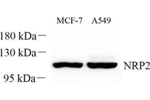 Western blot analysis of NRP2 (ABIN7074826) at dilution of 1: 300 (NRP2 antibody)