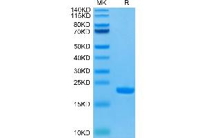 IL-1 beta Protein (AA 117-269) (His-Avi Tag)