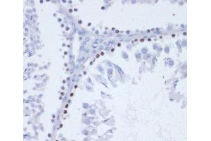 Immunohistochemistry of paraffin-embedded Rat testis using Phospho-γH2A. (gamma H2AX antibody  (pSer139))