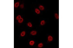 ABIN6274073 staining K562 by IF/ICC. (CDKN1C antibody  (C-Term))