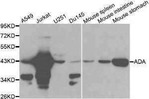 Western blot analysis of extracts of various cell lines, using ADA antibody. (ADA antibody  (AA 1-363))