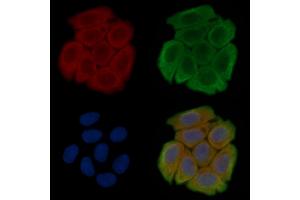 ABIN6257992 and ABIN6275831 staining Hela cells(45 min of heat-shock treatment) by IF/ICC. (TRAF2 antibody  (C-Term))