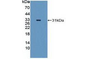 Figure. (MEK2 antibody  (AA 86-331))