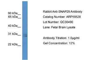 WB Suggested Anti-SNAP29  Antibody Titration: 0. (SNAP29 antibody  (Middle Region))