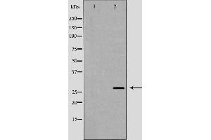 Western blot analysis of extracts of SH-SY5Y  , using BDNF antibody. (BDNF antibody  (Internal Region))