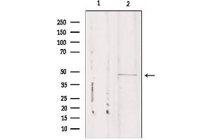 Western blot analysis of extracts from Mouse cancer, using CSTF1 Antibody. (CSTF1 antibody  (N-Term))