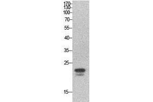 Western Blot (WB) analysis of HeLa cells using SRY Polyclonal Antibody.