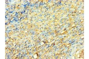 Immunohistochemistry of paraffin-embedded human tonsil tissue using ABIN7175904 at dilution of 1:100 (XRCC5 antibody  (AA 543-732))