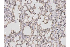 Immunohistochemistry (IHC) image for anti-Baculoviral IAP Repeat-Containing 5 (BIRC5) antibody (ABIN1875407) (Survivin antibody)