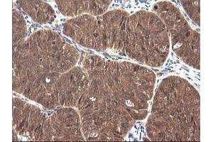 Image no. 2 for anti-Cancer/testis Antigen 1B (CTAG1B) antibody (ABIN1499895) (CTAG1B antibody)