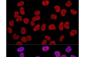 Confocal immunofluorescence analysis of Hela cells using KHDRBS1 Polyclonal Antibody at dilution of 1:400. (KHDRBS1 antibody)