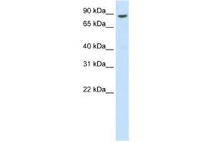 Western Blotting (WB) image for anti-BRF1, RNA polymerase III transcription initiation factor subunit (BRF1) (C-Term) antibody (ABIN927925)