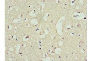 Immunohistochemistry of paraffin-embedded human brain tissue using ABIN7151243 at dilution of 1:100 (TRIM13 antibody  (AA 40-310))
