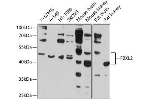 Western blot analysis of extracts of various cell lines, using FBXL2 antibody (ABIN6130377, ABIN6140508, ABIN6140509 and ABIN6214495) at 1:1000 dilution. (FBXL2 antibody  (AA 120-240))