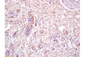 Formalin-fixed and paraffin embedded human kidney labeled with Anti-PRKAA2/AMPK alpha 2 Polyclonal Antibody, Unconjugated (ABIN680458) at 1:200 followed by conjugation to the secondary antibody and DAB staining (PRKAA2 antibody  (AA 351-450))