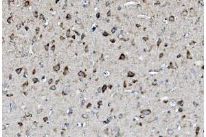 IHC analysis of MEK2/MAP2K2 using anti-MEK2/MAP2K2 antibody (ABIN7599357).