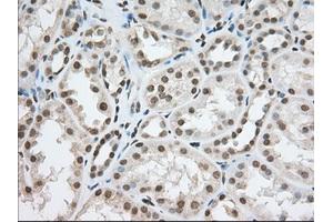 Image no. 8 for anti-Transforming, Acidic Coiled-Coil Containing Protein 3 (TACC3) antibody (ABIN1498096)