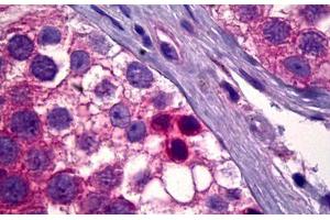 Anti-PDK1 antibody IHC staining of human testis, spermatogonia. (PDPK1 antibody)