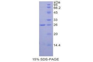 SDS-PAGE (SDS) image for Spectrin alpha Chain, Brain (SPTAN1) (AA 2071-2269) protein (His tag) (ABIN1877415) (SPTAN1 Protein (AA 2071-2269) (His tag))