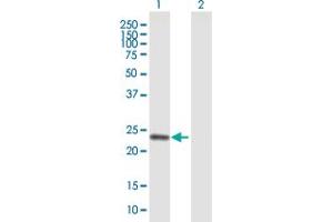 Western Blot analysis of COMT expression in transfected 293T cell line by COMT MaxPab polyclonal antibody. (COMT antibody  (AA 1-221))