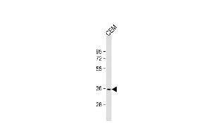 Anti-RN Antibody (Center) at 1:2000 dilution + CEM whole cell lysate Lysates/proteins at 20 μg per lane. (RNF126 antibody  (AA 84-115))