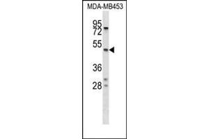 Western blot analysis of SERPINA5 Antibody (N-term) Cat.
