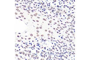 Immunohistochemistry of paraffin-embedded human tonsil using H3K36me2 antibody. (Histone 3 antibody  (H3K36me2))