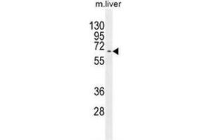 Western blot analysis in mouse liver tissue lysates (35ug/lane) using KY Antibody (N-term). (Kyphoscoliosis Peptidase antibody  (N-Term))