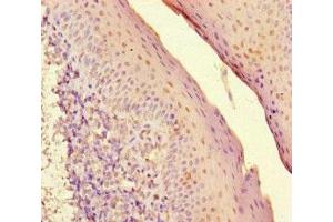 Immunohistochemistry of paraffin-embedded human tonsil tissue using ABIN7155525 at dilution of 1:100 (SUV39H1 antibody  (AA 179-412))