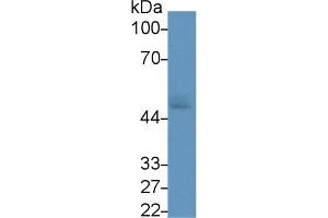 Detection of GLUT1 in Human Saliva using Monoclonal Antibody to Glucose Transporter 1 (GLUT1)