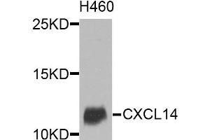 Western blot analysis of extracts of various cells, using CXCL14 antibody. (CXCL14 antibody)