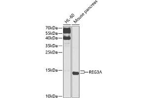 Western blot analysis of extracts of various cell lines, using REG3A antibody (ABIN6132545, ABIN6146855, ABIN6146856 and ABIN6216122) at 1:1000 dilution.
