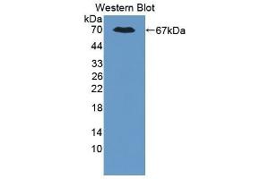 Western Blotting (WB) image for anti-Polybromo 1 (PBRM1) (AA 1-306) antibody (ABIN1111129) (Polybromo 1 antibody  (AA 1-306))