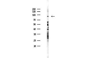 anti-Phosphoinositide 3 Kinase, p85 alpha (PI3K p85a) (pTyr607) antibody