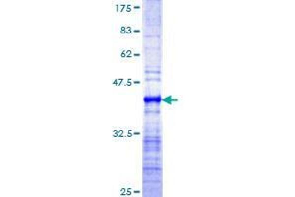 RNF169 Protein (AA 643-742) (GST tag)