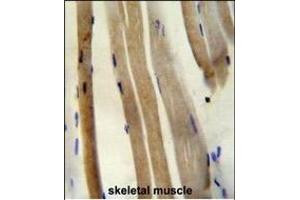 CS Antibody (N-term) (ABIN652074 and ABIN2840538) immunohistochemistry analysis in formalin fixed and paraffin embedded human skeletal muscle followed by peroxidase conjugation of the secondary antibody and DAB staining. (CS (AA 27-55), (N-Term) antibody)