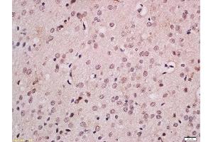 Formalin-fixed and paraffin embedded rat brain labeled with Anti-FOXB1 Polyclonal Antibody, Unconjugated  at 1:200 followed by conjugation to the secondary antibody and DAB staining. (FOXB1 antibody  (AA 1-100))