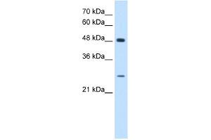 WB Suggested Anti-SH3BGR Antibody Titration:  0. (SH3BGR antibody  (N-Term))