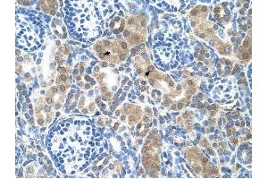 CBS antibody was used for immunohistochemistry at a concentration of 4-8 ug/ml to stain Epithelial cells of renal tubule (arrows) in Human Kidney. (CBS antibody  (N-Term))