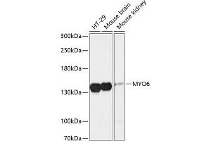 Western blot analysis of extracts of various cell lines, using MYO6 antibody (ABIN6129617, ABIN6144291, ABIN6144292 and ABIN6216869) at 1:3000 dilution. (Myosin VI antibody  (AA 1016-1285))