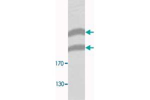 Western blot analysis of HeLa membrane fraction lysate with PLXNB1 polyclonal antibody  at 1 : 300 dilution.