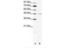 Image no. 1 for anti-Cholinergic Receptor, Nicotinic, delta (Muscle) (CHRND) (N-Term) antibody (ABIN202701) (CHRND antibody  (N-Term))