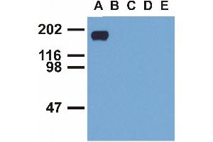 Western blotting analysis of EGFR (phospho-Tyr992) by mouse monoclonal antibody EM-12 inEGF-treated A431 (A), CALU-3 (B), MCF-7 (C), Jurkat (D) and Ramos (E) cell lines (reduced conditions).