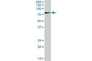 LIMK2 MaxPab rabbit polyclonal antibody. (LIMK2 antibody  (AA 1-686))